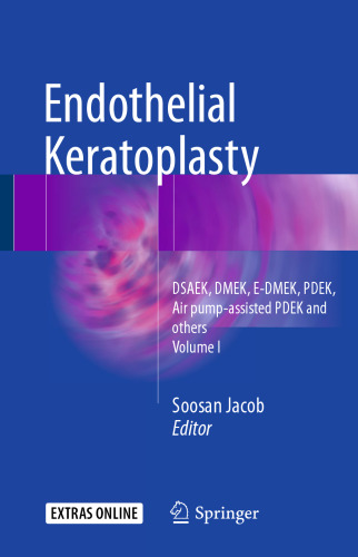 Mastering Endothelial Keratoplasty: DSAEK, DMEK, E-DMEK, PDEK, Air pump-assisted PDEK and others, Volume I