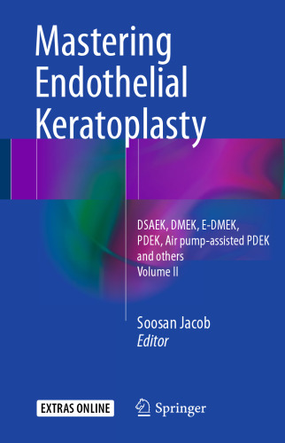 Mastering Endothelial Keratoplasty : DSAEK, DMEK, E-DMEK, PDEK, Air pump-assisted PDEK and others, Volume II