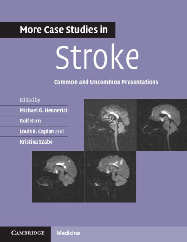More Case Studies in Stroke: Common and Uncommon Presentations