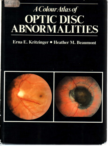 A Colour Atlas of Optic Disc Abnormalities