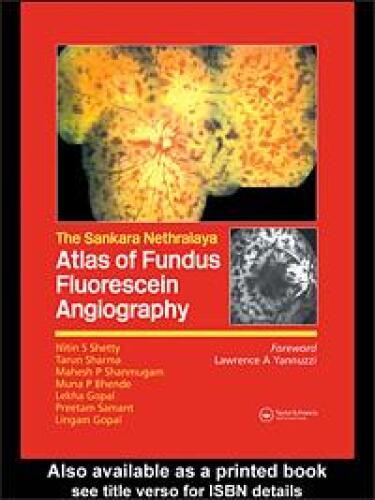Atlas of Fundus Fluorescein Angiography