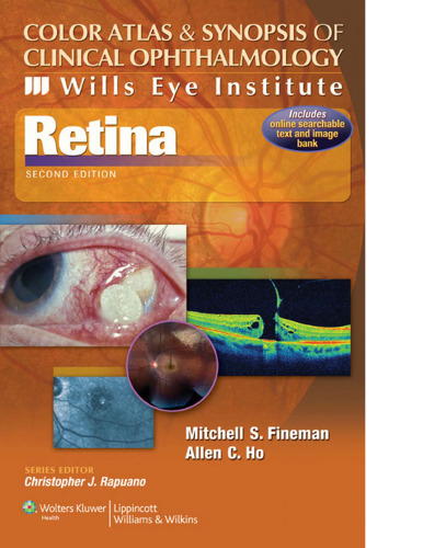 Color Atlas and Synopsis of Clinical Ophthalmology - Retina