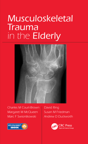 Musculoskeletal Trauma in the Elderly