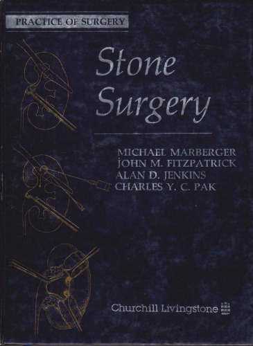 Stone Surgery
