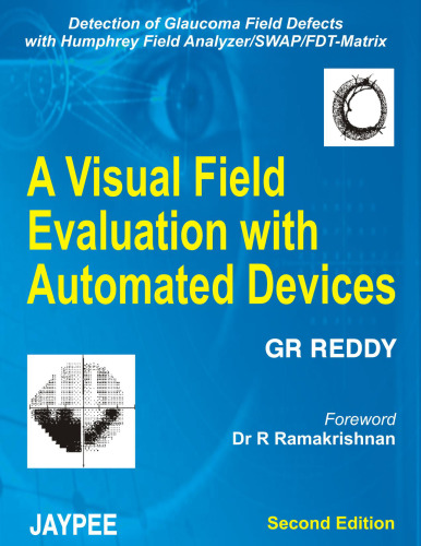 A Visual Evaluation with Automate Devices