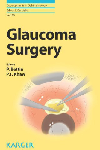 Glaucoma Surgery