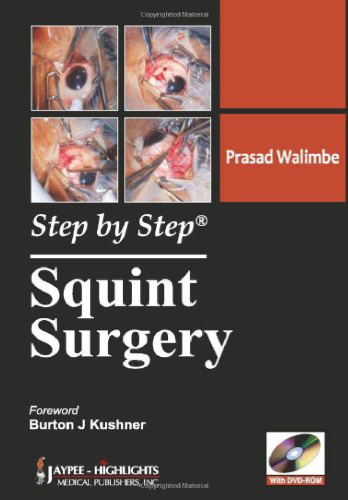 Squint surgery