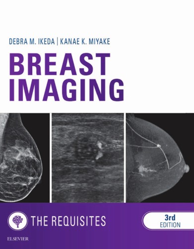 Breast Imaging The Requisites