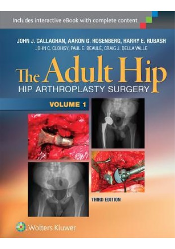 The adult hip: Hip arthroplasty surgery