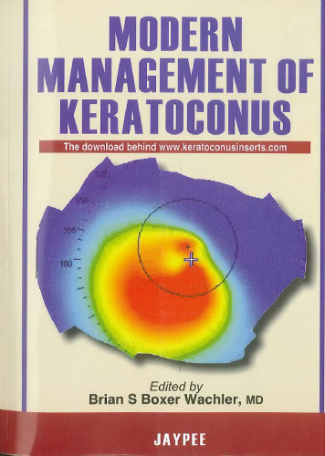 Modern Management of Keratoconus