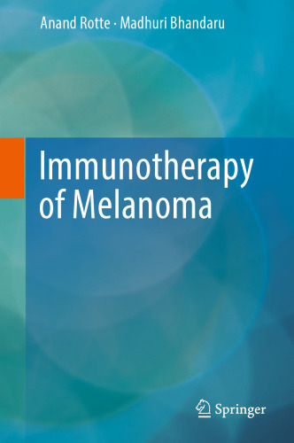 Immunotherapy of Melanoma