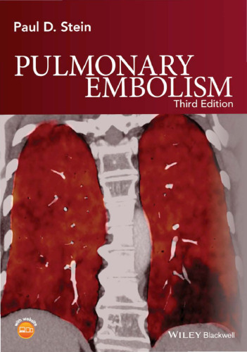 Pulmonary embolism