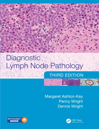 Diagnostic Lymph Node Pathology, Third Edition