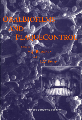 Oral biofilms and plaque control