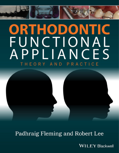 Orthodontic functional appliances: theory and practice