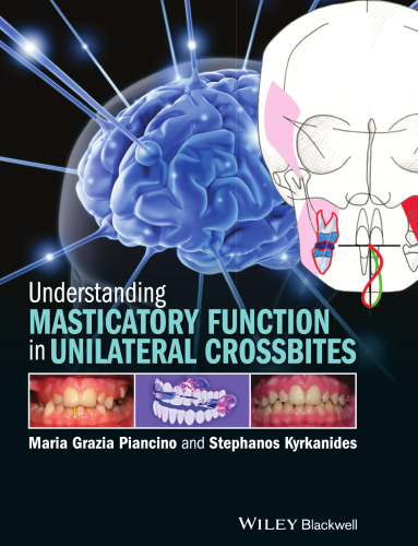 Understanding masticatory function in unilateral crossbites