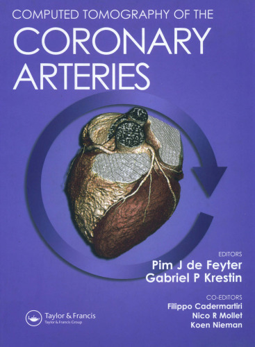 Computed tomography of the coronary arteries