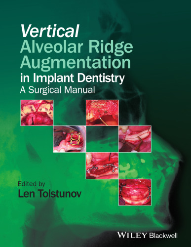 Vertical alveolar ridge augmentation in implant dentistry : a surgical manual