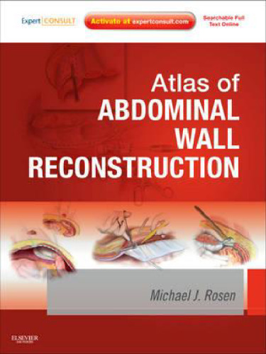 Atlas of Abdominal Wall Reconstruction