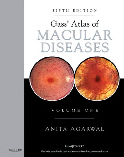 Gass’ Atlas of Macular Diseases