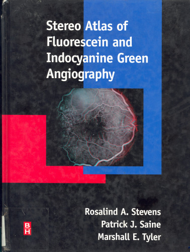 Stereo atlas of fluorescein and indocyanine green angiography