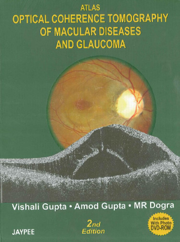 Atlas Optical Coherence Tomography of Macular Diseases and Glaucoma