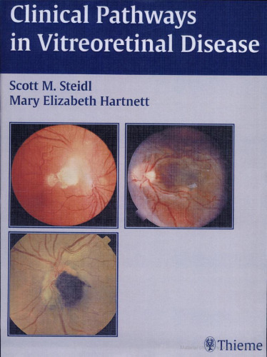 Clinical Pathways In Vitreoretinal Disease