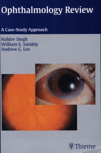 Ophthalmology Review: A Case Study Approach