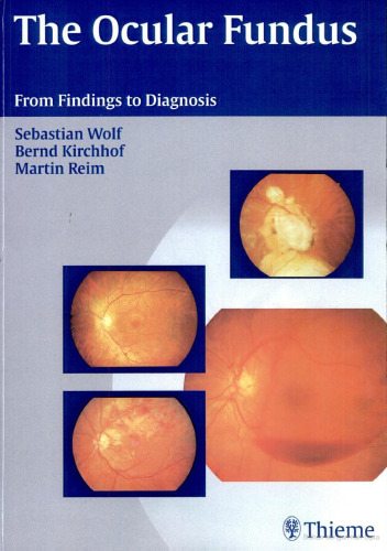 The Ocular Fundus: From Findings to Diagnosis