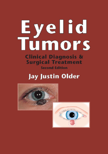 Eyelid Tumours: Clinical Diagnosis and Surgical Treatment