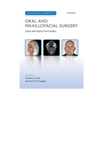 Challenging Concepts in Oral and Maxillofacial Surgery: Cases with Expert Commentary