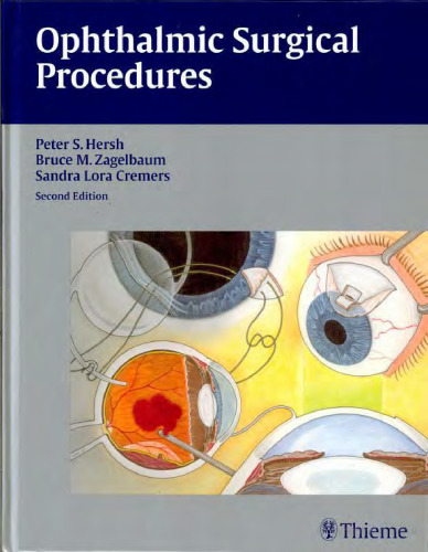 Ophthalmic Surgical Procedures