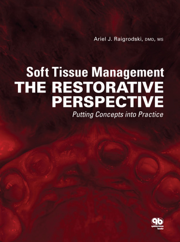 Soft Tissue Management: The Restorative Perspective: Putting Concepts into Practice