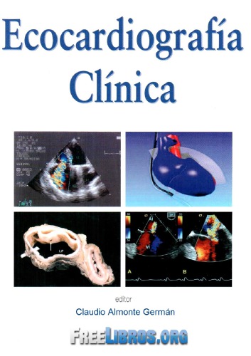 De la clínica a la ecocardiografía