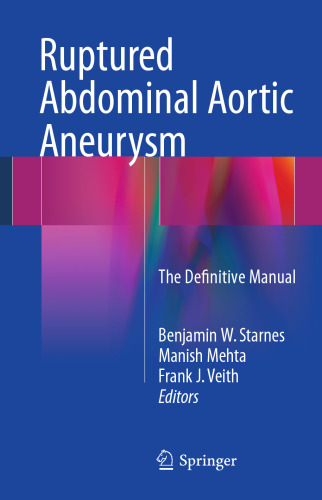 Ruptured Abdominal Aortic Aneurysm: The Definitive Manual