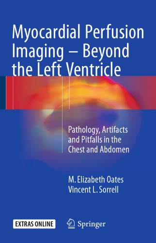 Myocardial Perfusion Imaging - Beyond the Left Ventricle: Pathology, Artifacts and Pitfalls in the Chest and Abdomen