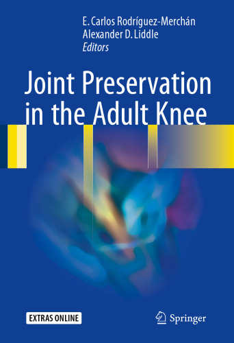 Joint Preservation in the Adult Knee