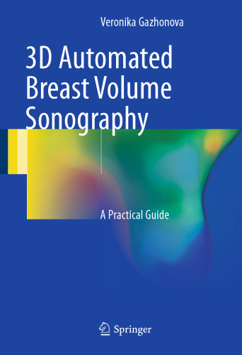 3D Automated Breast Volume Sonography: A Practical Guide