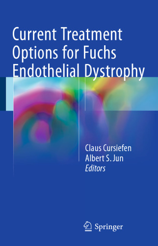 Current Treatment Options for Fuchs Endothelial Dystrophy