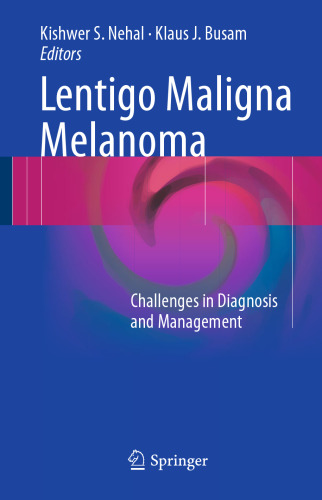 Lentigo Maligna Melanoma: Challenges in Diagnosis and Management