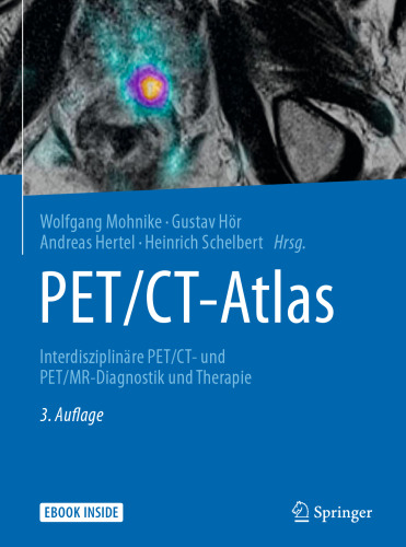 PET/CT-Atlas: Interdisziplinäre PET/CT- und PET/MR-Diagnostik und Therapie