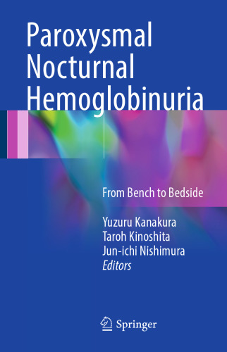 Paroxysmal Nocturnal Hemoglobinuria: From Bench to Bedside