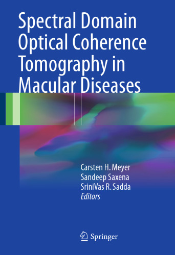 Spectral Domain Optical Coherence Tomography in Macular Diseases