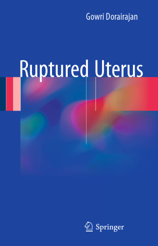 Ruptured Uterus