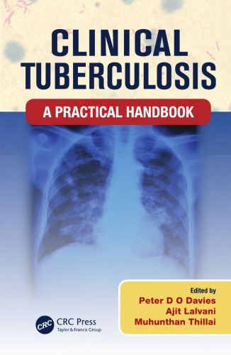 Clinical tuberculosis: a practical handbook