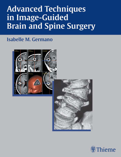 Advanced techniques in image-guided brain and spine surgery