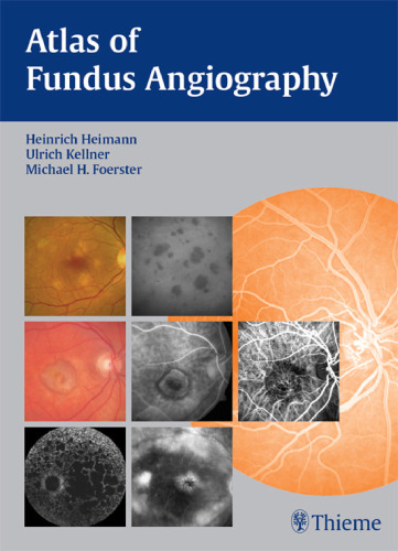 Atlas of fundus angiography