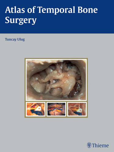 Atlas of temporal bone surgery
