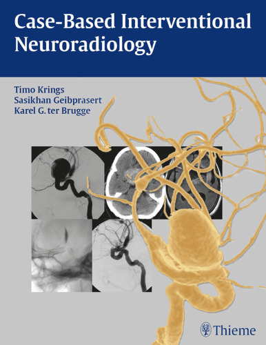 Case-based interventional neuroradiology