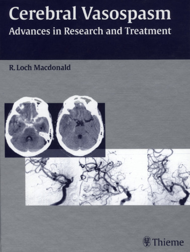 Cerebral vasospasm: advances in research and treatment: International Conference on Cerebral Vasospasm, 8th, 2003, Chicago, Ill